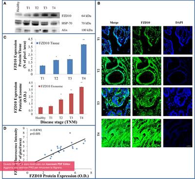 Exosome Released FZD10 Increases Ki-67 Expression via Phospho-ERK1/2 in Colorectal and Gastric Cancer